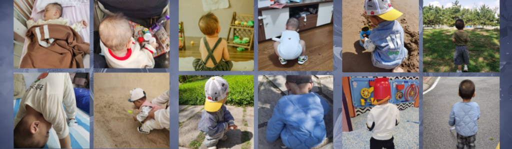 Postoperative Records of Tubao's Yolk Sac Tumor Postoperative Records of Tubao's Yolk Sac Tumor